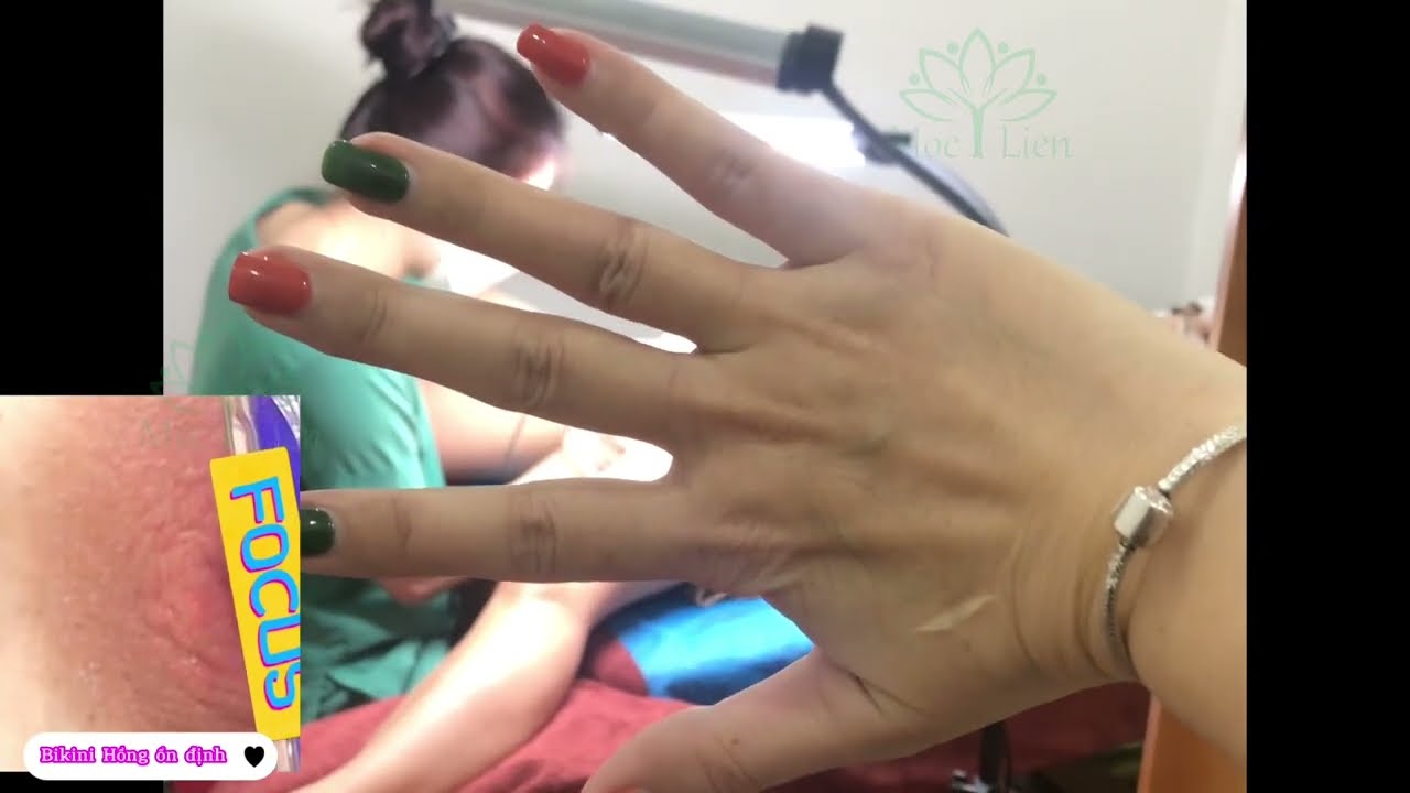 Gái xinh khoe bím không lông - Hiện tượng mạng gây tranh cãi và ảnh hưởng xã hội